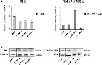 Anti-tumor Efficacy Assessment of the Sigma Receptor Pan Modulator RC-106. A Promising Therapeutic Tool for Pancreatic Cancer